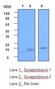 IHC-plus™ VAMP2 / VAMP-2 Antibody (aa1-89, clone 3E5)
