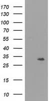 Monoclonal Mouse anti-Human NMNAT1 / NMNAT Antibody (clone OTI1F7, IF, WB)