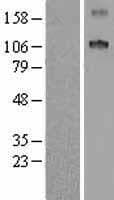 SCUBE1 Protein (Over-Expression Lysate Myc-DDK (Flag))