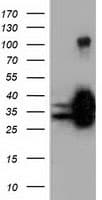 QPRT Antibody (clone OTI7A8)