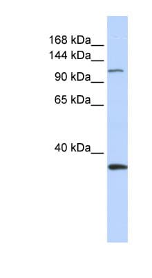 MCM2 Antibody (aa828-877)