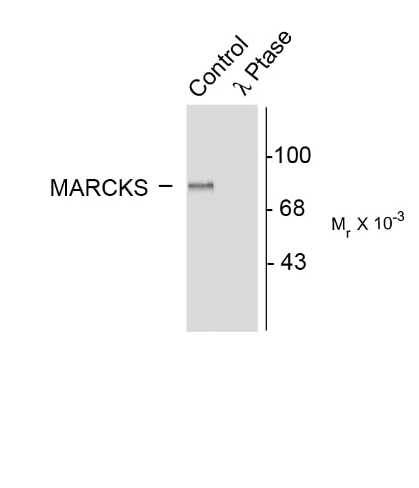 MARCKS Antibody (phospho-Ser152/Ser156)