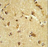 Polyclonal Rabbit anti-Human COAA / RBM14 Antibody (aa193-223, IHC, WB)