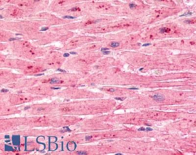 PathPlus™ Polyclonal Rabbit anti-Human ADGRL4 / ELTD1 Antibody (C-Terminus, IHC)