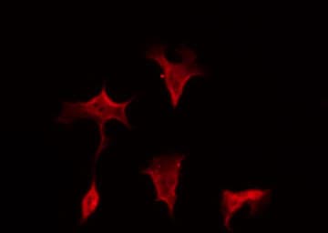 ARHGAP35 / GRLF1 Antibody