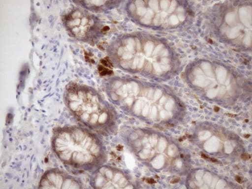 SSX2IP Antibody (aa1-272, clone OTI5C3)