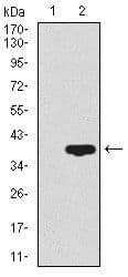 CD59 Antibody (Amino Acid: 31-111, clone 8D2B8)