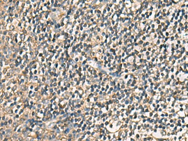 VTA1 Antibody