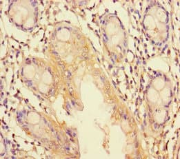 TRIM37 / TEF3 Antibody