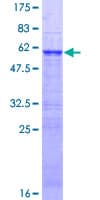 Human ZNF509 / ZBTB49 Protein (Recombinant GST)