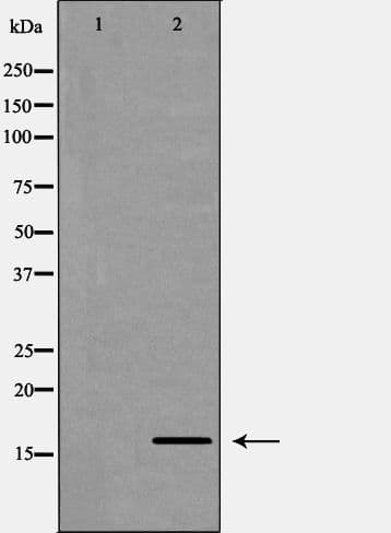 CDA / Cytidine Deaminase Antibody