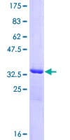 Human CARD16 / COP Protein (Recombinant GST)