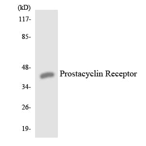 IHC-plus™ Polyclonal Rabbit anti-Human PTGIR / IP Receptor Antibody (aa188-237, IHC, WB)