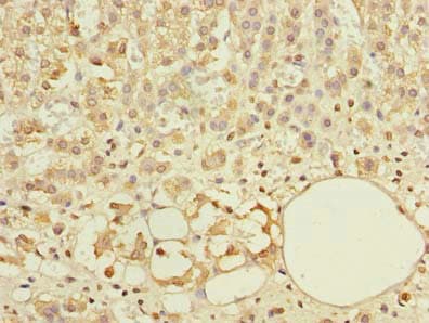 Polyclonal Rabbit anti-Human ABCF3 Antibody (IHC)