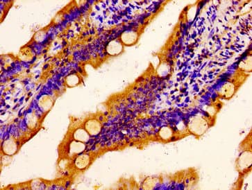 Polyclonal Rabbit anti-Human SCARA5 Antibody (IHC, IF)