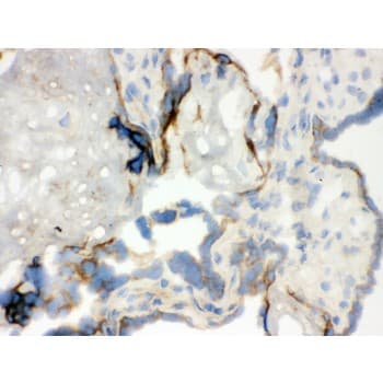 WAS / WASP Antibody (aa129-156)