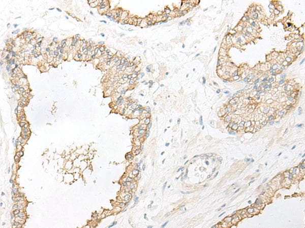 DHRS7 Antibody