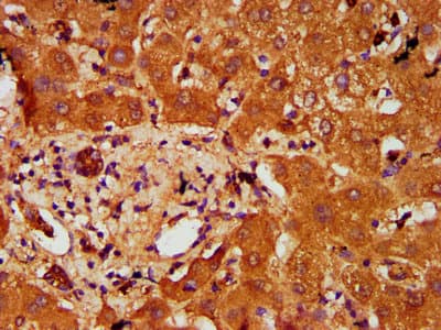 Polyclonal Rabbit anti-Human PTOV1 Antibody (IHC, IF)
