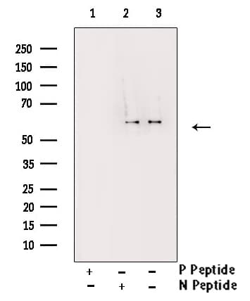 CDC25A Antibody (phospho-Ser178)