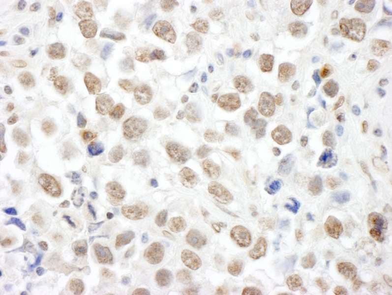 TOPORS Antibody (aa995-1045)