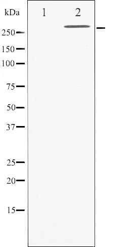 Polyclonal Rabbit anti-Human FLNA / Filamin A Antibody (IHC, IF, WB)