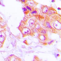Polyclonal Rabbit anti-Human GIT1 Antibody (C-Terminus, IHC, WB)