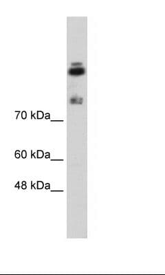 Polyclonal Rabbit anti-Human HDLBP / Vigilin Antibody (N-Terminus, IHC, WB)
