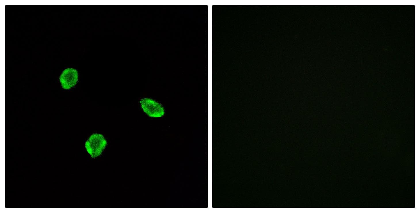 SSTR1 Antibody