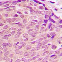 PDK2 Antibody (Internal)