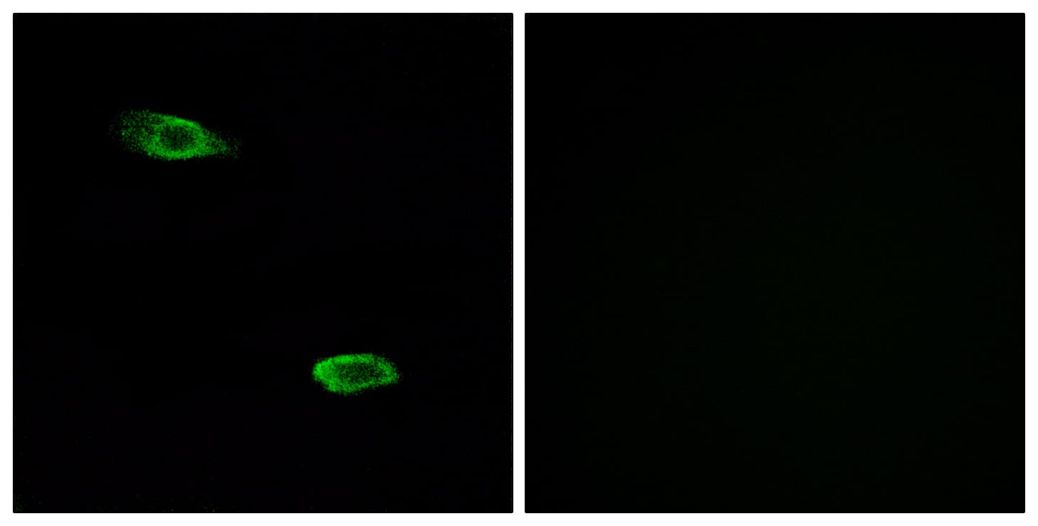 OR51E2 / PSGR Antibody (aa221-270)
