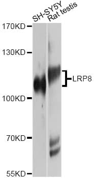 APOER2 / LRP8 Antibody