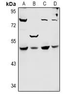 Polyclonal Rabbit anti-Human SYT11 Antibody (WB)