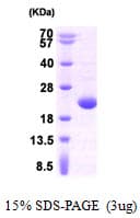 Human APRT Protein (Recombinant)