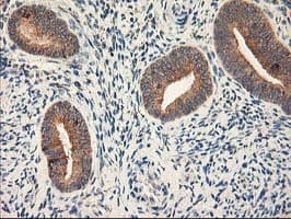 RPN1 / Ribophorin I Antibody (clone OTI6A9)