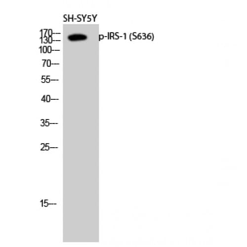 IRS1 Antibody (570-650 aa)