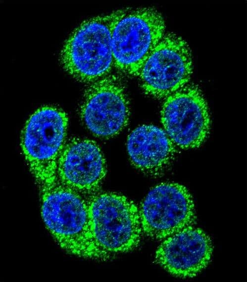 Polyclonal Rabbit anti-Human HYOU1 / ORP150 Antibody (aa274-303, IHC, IF, WB)