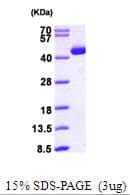 Human ACAT2 Protein (Recombinant His)