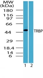 TARBP2 / TRBP2 Antibody (aa340-390)