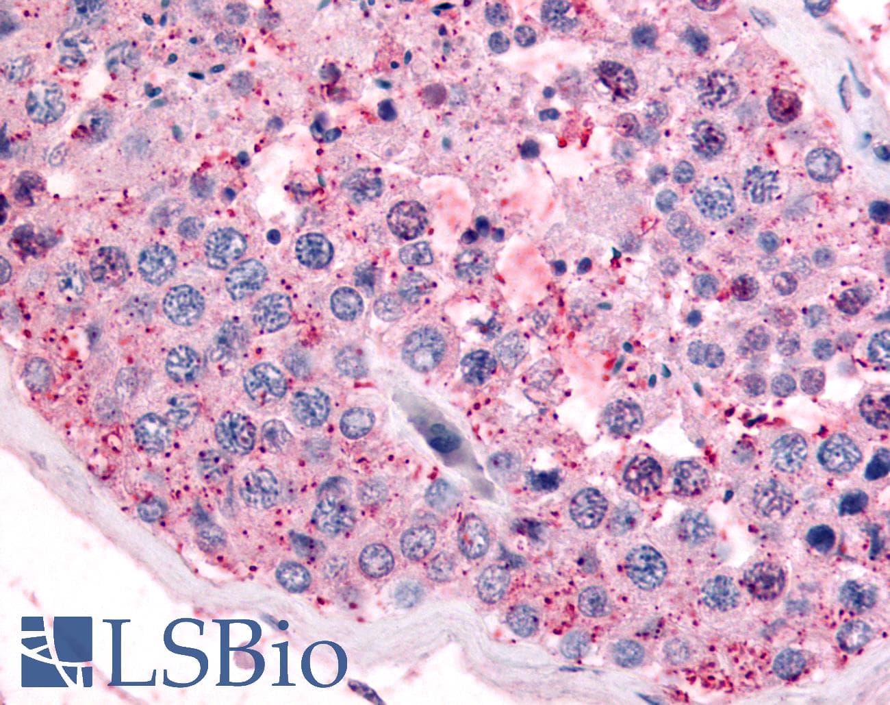 IHC-plus™ Polyclonal Rabbit anti-Human PAK6 Antibody (N-Terminus, IHC)
