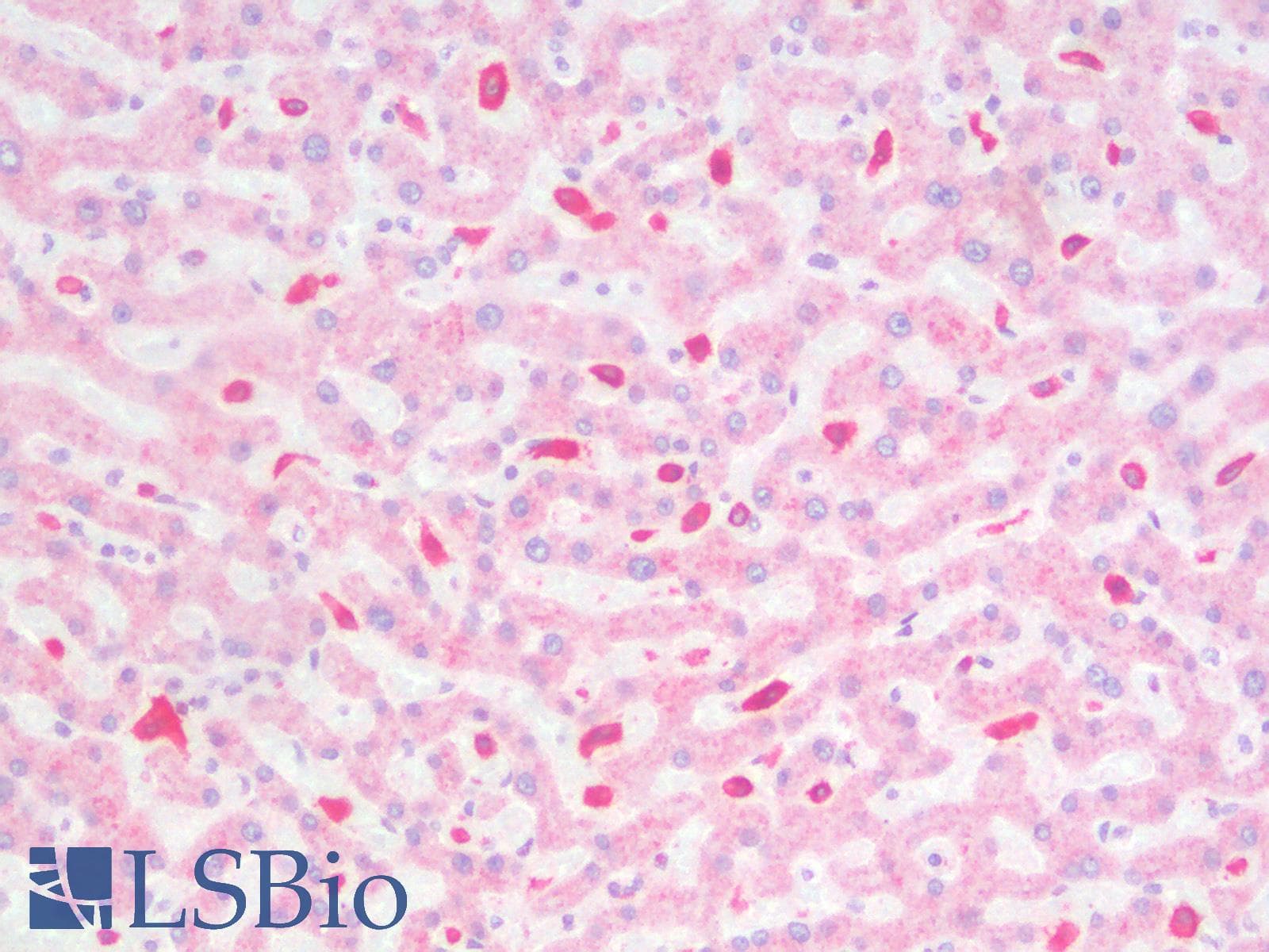 PathPlus™ Polyclonal Rabbit anti-Human CD163 Antibody (IHC)