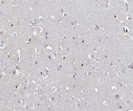 MEF2C Antibody