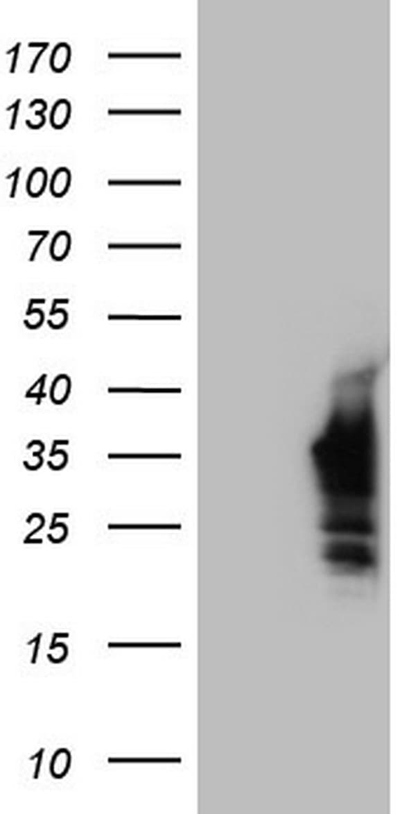 NKX3-1 Antibody (clone OTI4H6)