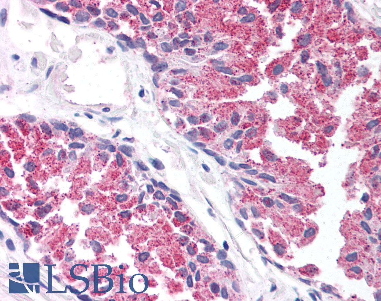 IHC-plus™ TBC1 / TBC1D1 Antibody