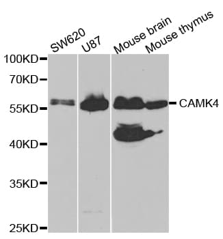 Polyclonal Rabbit anti-Human CAMK4 / CaMK IV Antibody (IHC, IF, WB)