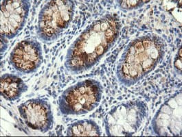 STK38L / NDR2 Antibody (clone OTI3E10)