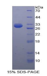 Human HK3 / Hexokinase 3 Protein (Recombinant His-T7)
