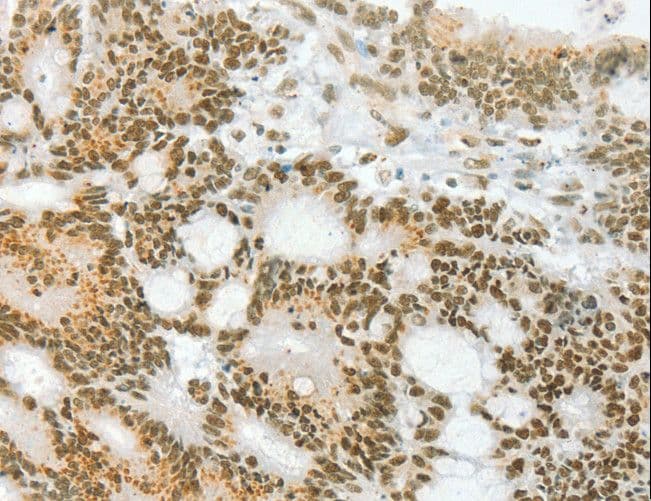 ANGPT4 / Angiopoietin-4 Antibody