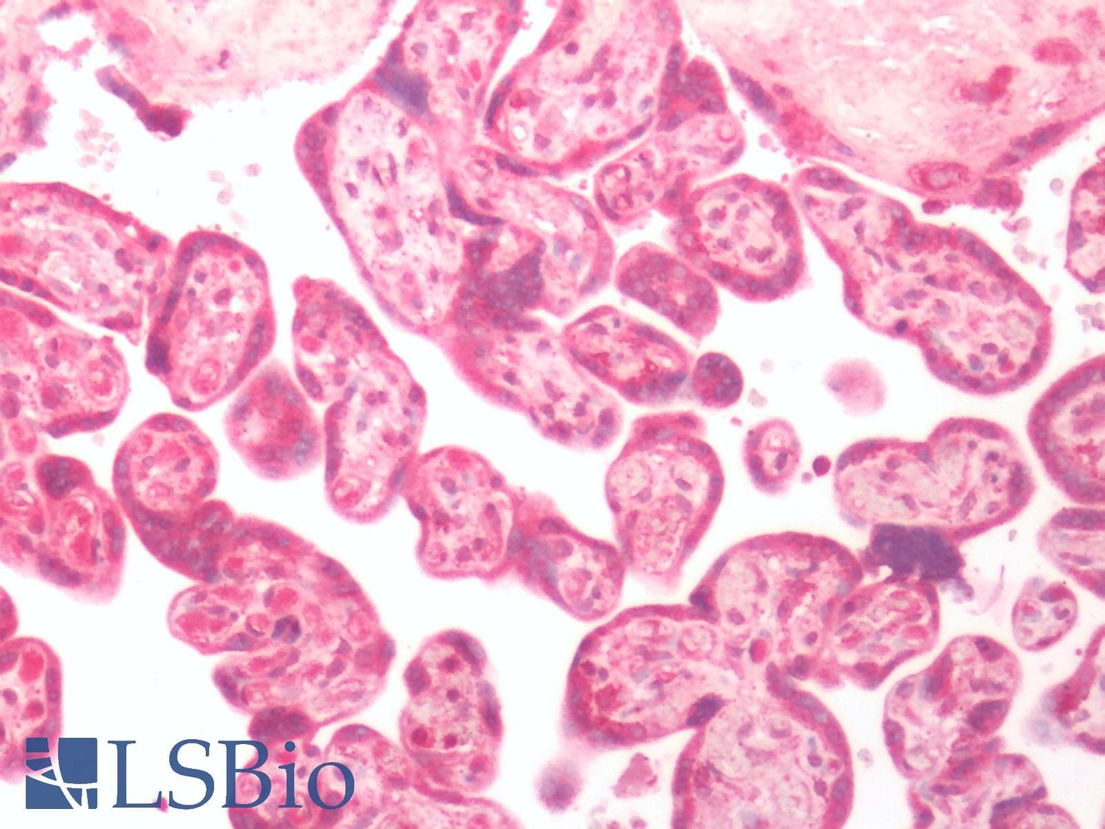 PathPlus™ Polyclonal Rabbit anti-Human GPER1 / GPR30 Antibody (C-Terminus, IHC, IF, WB)