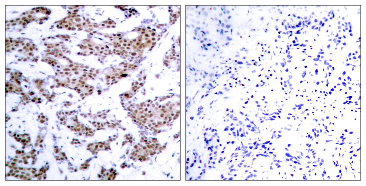 MEF2A / MEF2 Antibody (phospho-Thr312)