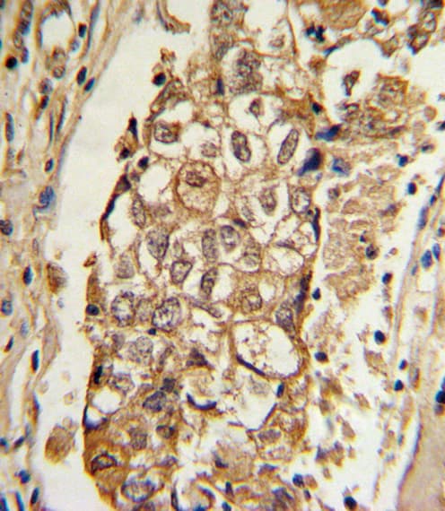 MCL1 / MCL 1 Antibody (aa191-226)